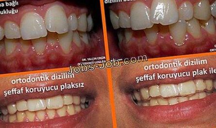 Dental Hijyenist Olma Rehberi